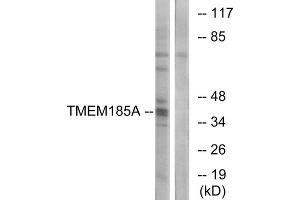 Western blot analysis of extracts from K562 cells, using TMEM185A antibody. (TMEM185A anticorps  (C-Term))