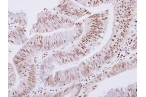 Image no. 1 for anti-Zinc Finger and SCAN Domain Containing 32 (ZSCAN32) (AA 64-237) antibody (ABIN1501845)