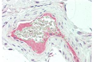 Rabbit Anti-F13B antibody  Formalin Fixed Paraffin Embedded Tissue: Human Vessel Primary antibody Concentration: 1:100 Secondary Antibody: Donkey anti-Rabbit-Cy3 Secondary Antibody Concentration: 1:200 Magnification: 20x Exposure Time: 0.