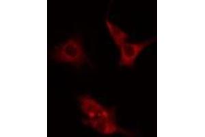 ABIN6275582 staining  Hela cells by IF/ICC. (NHE7 anticorps  (Internal Region))