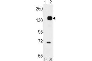 Western blot analysis of TIE2 antibody and 293 cell lysate either nontransfected (Lane 1) or transiently transfected with the TEK gene (2).