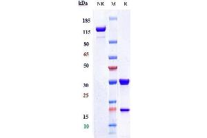 Anti-CEACAM5 / CEA / CD66e Reference Antibody (tusamitamab) on SDS-PAGE under reducing (R) condition. (Recombinant CEACAM5 (Tusamitamab Biosimilar) anticorps)