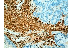 Immunohistochemistry (IHC) image for anti-Neurofilament 150, 200kD antibody (ABIN108435) (Neurofilament 150, 200kD anticorps)