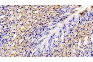 Detection of ANXA1 in Mouse Stomach Tissue using Polyclonal Antibody to Annexin A1 (ANXA1)