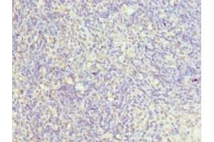 Immunohistochemistry of paraffin-embedded human thymus tissue using ABIN7147523 at dilution of 1:100 (CHMP2B anticorps  (AA 1-213))