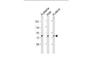 All lanes : Anti-LTF Antibody at 1:1000-2000 dilution Lane 1: Human plasma tissue lysate Lane 2: Hela whole cell lysate Lane 3: Human uterus tissue lysate Lysates/proteins at 20 μg per lane.