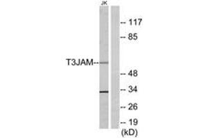 Western blot analysis of extracts from Jurkat cells, using T3JAM Antibody.