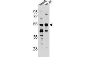 TEKT5 Antibody (Center) western blot analysis in HepG2,HL-60 cell line lysates (35 µg/lane). (TEKT5 anticorps  (Middle Region))
