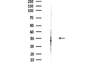 anti-Protein Kinase, Interferon-Inducible Double Stranded RNA Dependent Activator (PRKRA) (Internal Region) antibody