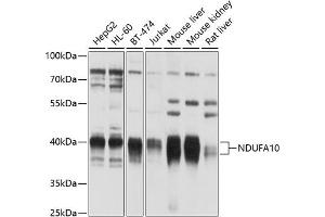 Western blot analysis of extracts of various cell lines, using NDUF antibody (123) at 1:1000 dilution. (NDUFA10 anticorps  (AA 36-300))