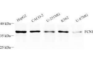 Western blot analysis of FCN1 (ABIN7073952),at dilution of 1: 1000 (FCN1 anticorps)