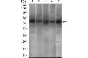 Western blot analysis using PDE1B mouse mAb against A549 (1), SK-MES-1 (2), PC-12 (4),3T3L1 (5) cell lysate and Mouse brain (3) tissue lysate. (PDE1B anticorps  (AA 370-536))
