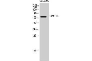 Western Blotting (WB) image for anti-G Protein-Coupled Receptor 114 (GPR114) (Internal Region) antibody (ABIN3184837) (GPR114 anticorps  (Internal Region))