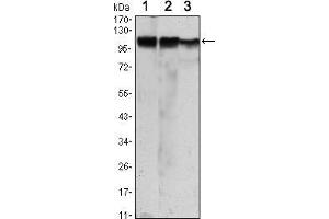 Western blot analysis using HK2 mouse mAb against Jurkat (1), Hela (2) and HEK293 (3) cell lysate. (Hexokinase 2 anticorps)