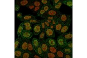 Immunofluorescence staining of paraformaldehyde-fixed HeLa cells with Annexin A1 Mouse Monoclonal Antibody (ANXA1/3566) followed by goat anti-Mouse IgG-CF488 (Green).