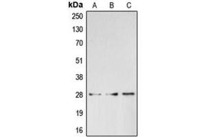 Western blot analysis of BRMS1 expression in HepG2 (A), HeLa (B), K562 (C) whole cell lysates. (BRMS1 anticorps  (C-Term))