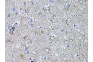 Immunohistochemistry of paraffin-embedded rat brain using MYH10 antibody.