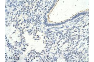 Rabbit Anti-GTF2F1 antibody        Paraffin Embedded Tissue:  Human Lung cell   Cellular Data:  Epithelial cells of renal tubule  Antibody Concentration:   4.