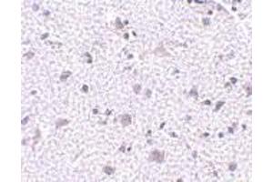 Immunohistochemistry of CDNF in human brain tissue with CDNF antibody at 5 μg/ml.