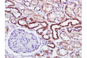 Paraformaldehyde-fixed, paraffin embedded human kidney tissue, Antigen retrieval by boiling in sodium citrate buffer(pH6) for 15min, Block endogenous peroxidase by 3% hydrogen peroxide for 30 minutes, Blocking buffer (normal goat serum) at 37°C for 20min, Antibody incubation with Rabbit Anti-PKR(Thr446) Polyclonal Antibody, Unconjugated  at 1:500 overnight at 4°C, followed by a conjugated secondary and DAB staining