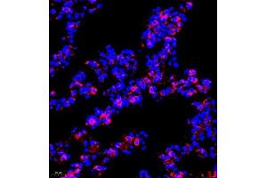 Immunofluorescence of paraffin embedded mouse lung using P4H (ABIN7074215) at dilution of 1:700 (400x lens) (HIF Prolyl Hydroxylase anticorps)