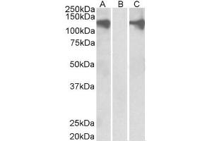 Western Blotting (WB) image for anti-Pumilio Homolog 2 (Drosophila) (PUM2) antibody (ABIN5930779) (PUM2 anticorps)