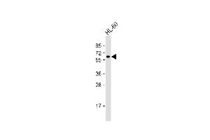Anti-KLHL3 Antibody (Center) at 1:1000 dilution + HL-60 whole cell lysate Lysates/proteins at 20 μg per lane.