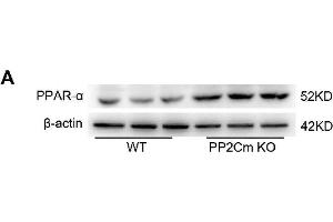 Exacerbated I/R injury in the PP2Cm KO heart is rescued by PPAR-α knockdown. (beta Actin anticorps)