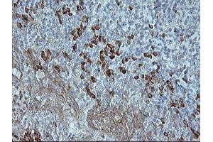 Image no. 2 for anti-Mitogen-Activated Protein Kinase 9 (MAPK9) antibody (ABIN1498927)