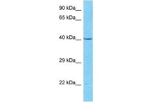 Host:  Rabbit  Target Name:  PSMD6  Sample Type:  MCF7 Whole Cell lysates  Antibody Dilution:  1. (PSMD6 anticorps  (N-Term))