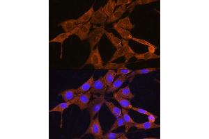 Immunofluorescence analysis of NIH/3T3 cells using NMN Rabbit pAb (ABIN7268910) at dilution of 1:100. (NMNAT3 anticorps  (AA 1-215))