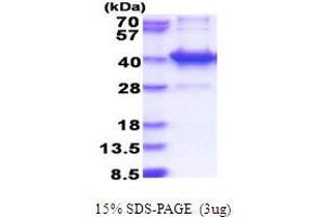 AMMECR1-Like (AMMECR1L) (AA 1-310) protein (His tag)
