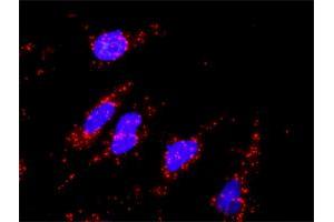 Proximity Ligation Analysis of protein-protein interactions between DKK1 and CTNNB1.