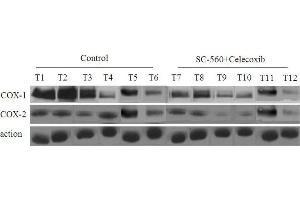 COX protein levels in xenograft tumors of nude mice treated or not treated with combined treatment of SC-560 and celecoxib. (PTGS1 anticorps  (AA 151-250))
