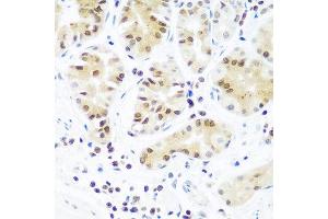 Immunohistochemistry of paraffin-embedded human stomach using AGO2 antibody at dilution of 1:100 (40x lens). (AGO2 anticorps)