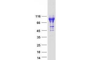 Validation with Western Blot