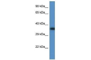 Western Blot showing Fbxo32 antibody used at a concentration of 1. (FBXO32 anticorps  (C-Term))