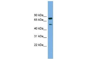 WB Suggested Anti-RBM42 Antibody Titration: 0. (RBM42 anticorps  (Middle Region))