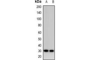 Western blot analysis of Calsarcin 1 expression in HepG2 (A), MDAMB453 (B) whole cell lysates.
