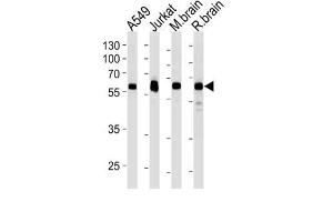 Western Blotting (WB) image for anti-Ubiquitin Specific Peptidase 14 (USP14) antibody (ABIN3004701)