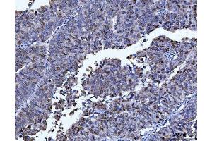 IHC analysis of FEN1 using anti-FEN1 antibody (ABIN7601619). (FEN1 anticorps  (AA 4-300))