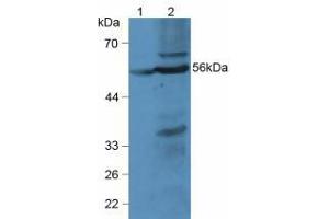 Figure. (LPCAT3 anticorps  (AA 122-233))
