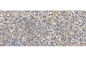 Immunohistochemistry of paraffin-embedded Human tonsil tissue using APOBR Polyclonal Antibody at dilution of 1:35(x200) (APOBR anticorps)