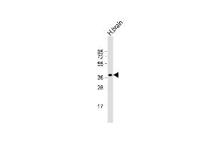 Anti-CEAC Antibody (N-term) at 1:1000 dilution + human brain lysate Lysates/proteins at 20 μg per lane. (CEACAM18 anticorps  (N-Term))