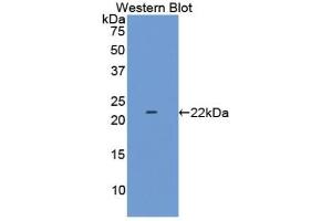 Detection of Recombinant LAMC2, Human using Polyclonal Antibody to Laminin Gamma 2 (LAMC2)