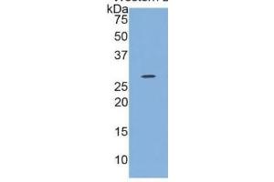 WB of Protein Standard: different control antibodies  against Highly purified E. (IL12A Kit ELISA)
