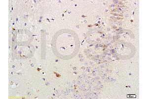 Formalin-fixed and paraffin-embedded mouse brain labeled with Rabbit Anti-Versican Polyclonal Antibody, Unconjugated (ABIN741660) 1:200 followed by conjugation to the secondary antibody and DAB staining (Versican anticorps  (AA 3301-3396))