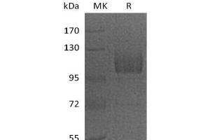 Western Blotting (WB) image for CD36 (CD36) (Active) protein (Fc Tag) (ABIN7320791) (CD36 Protein (CD36) (Fc Tag))