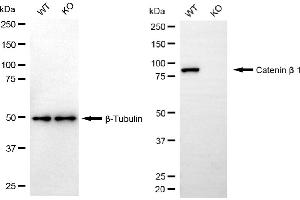 Western blotting analysis using catenin beta 1 antibody (ABIN7797926).