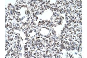 TMPRSS11D antibody was used for immunohistochemistry at a concentration of 4-8 ug/ml to stain Alveolar cells (arrows) in Human Lung. (TMPRSS11D anticorps  (N-Term))